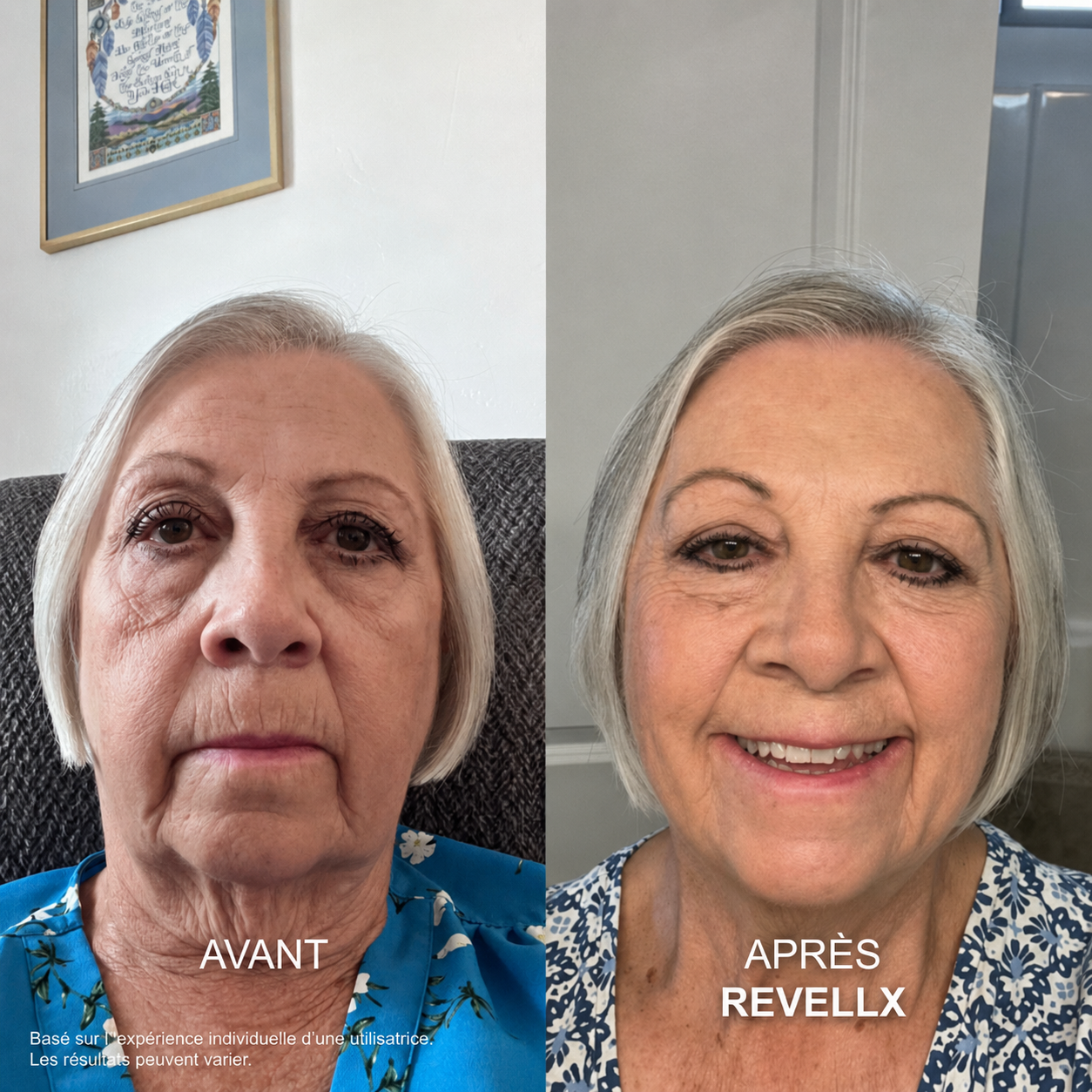 Revellx™ | Système de micro-infusion antige âge