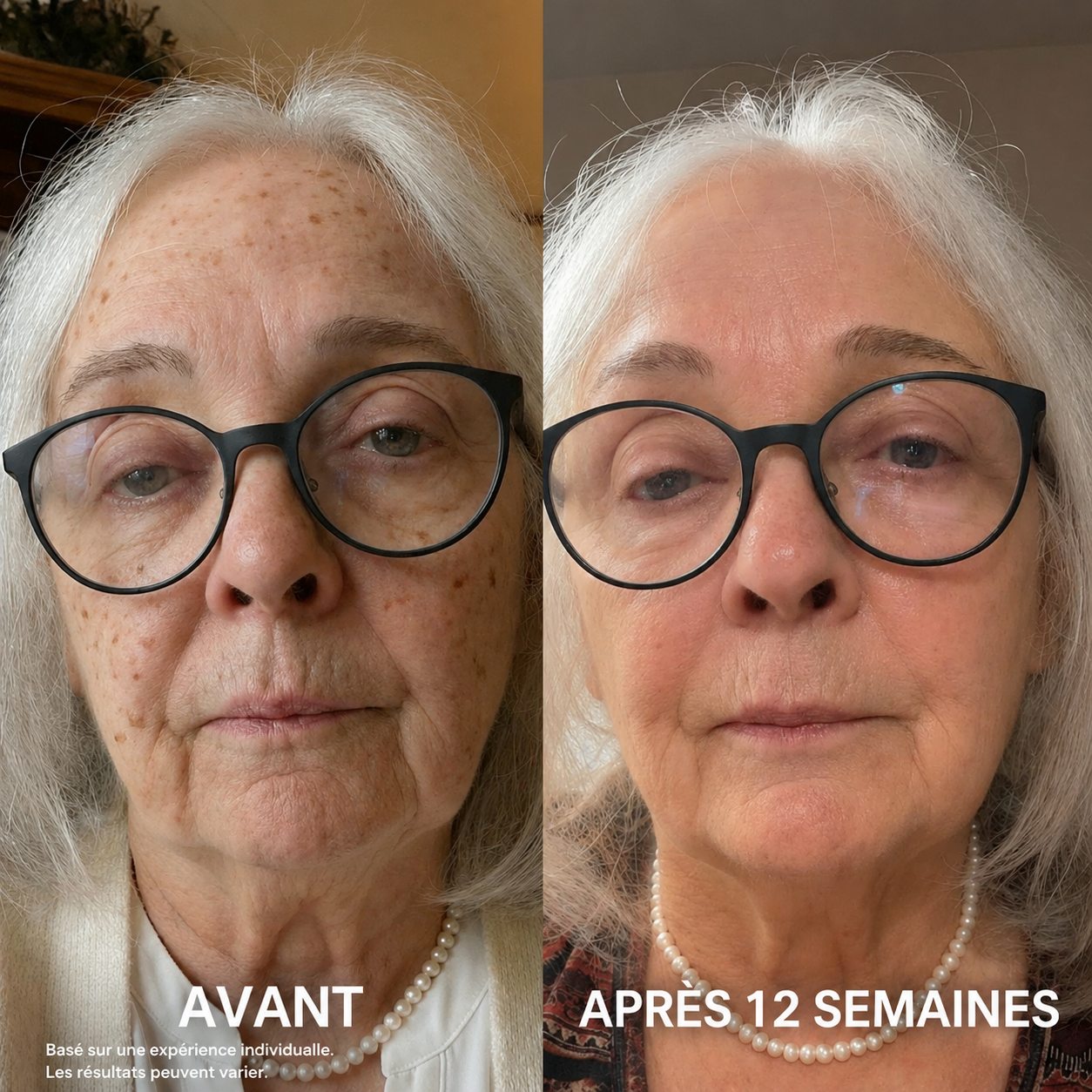 Revellx™ | Système de micro-infusion antige âge