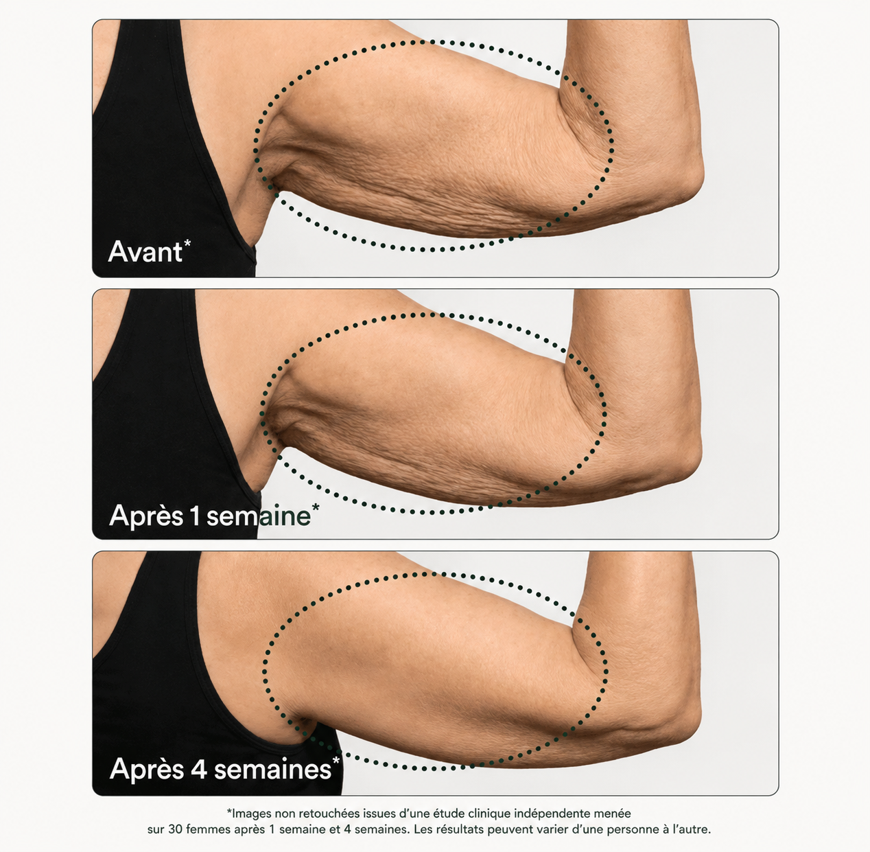 Revellx™ | Crème corporelle raffermissante intense