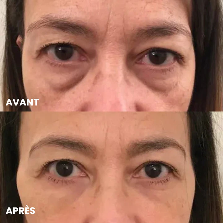 Suzanne B. (66 ans)