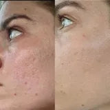Élodie M., 32 ans