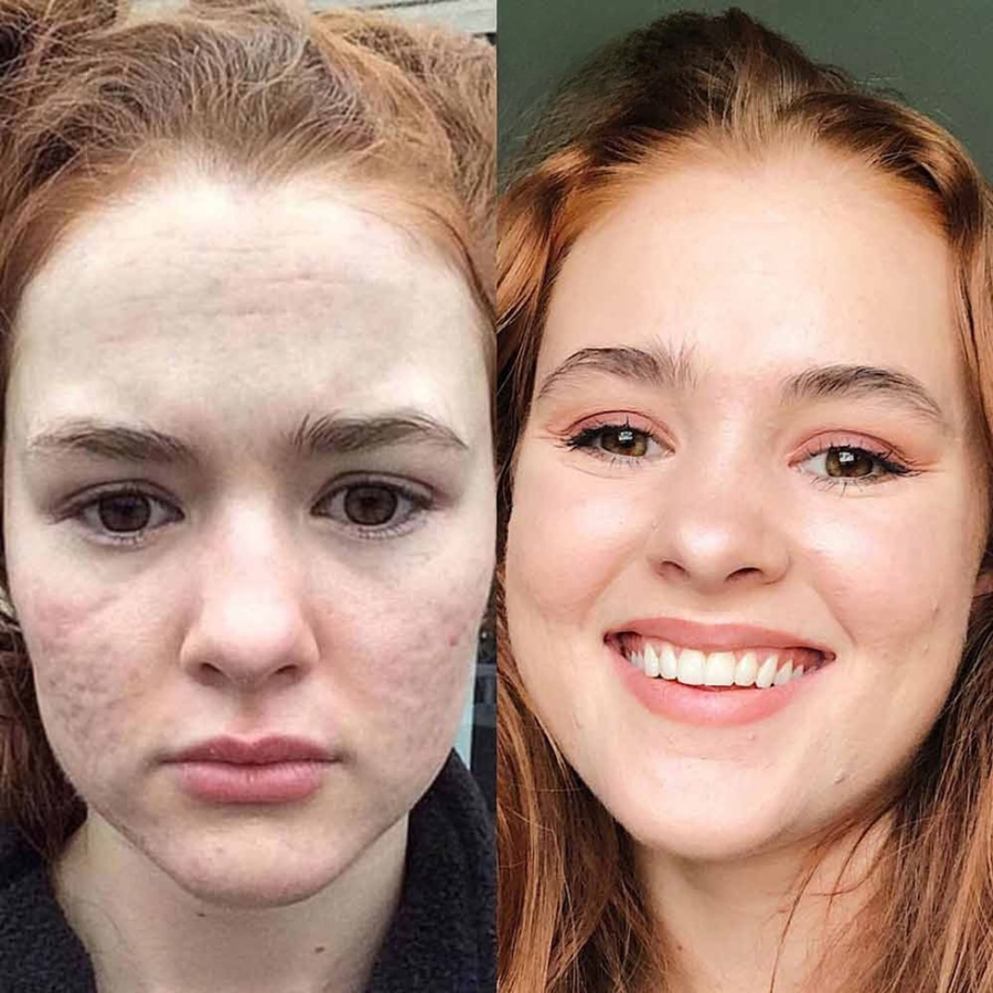Léa, 24 ans