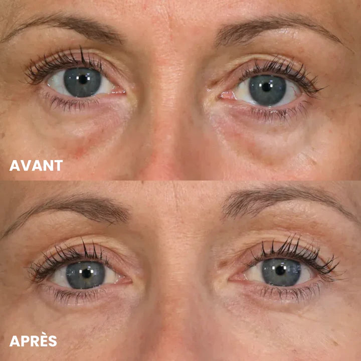 Louise V. (65 ans)