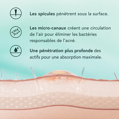 Revellx™ | Sérum Microneedling — Cicatrices d'acné