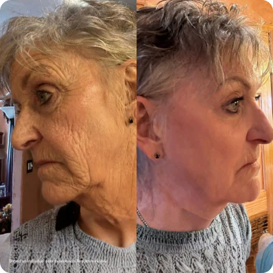 Cécile T. (65 ans)
