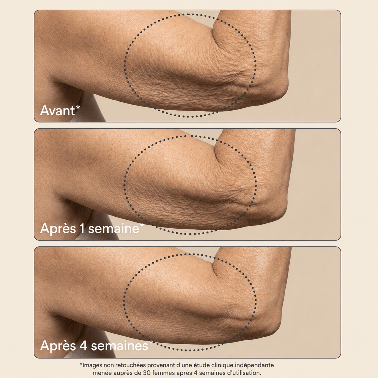 Revellx™ | Crème corporelle raffermissante intense