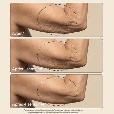 Revellx™ | Crème corporelle raffermissante intense
